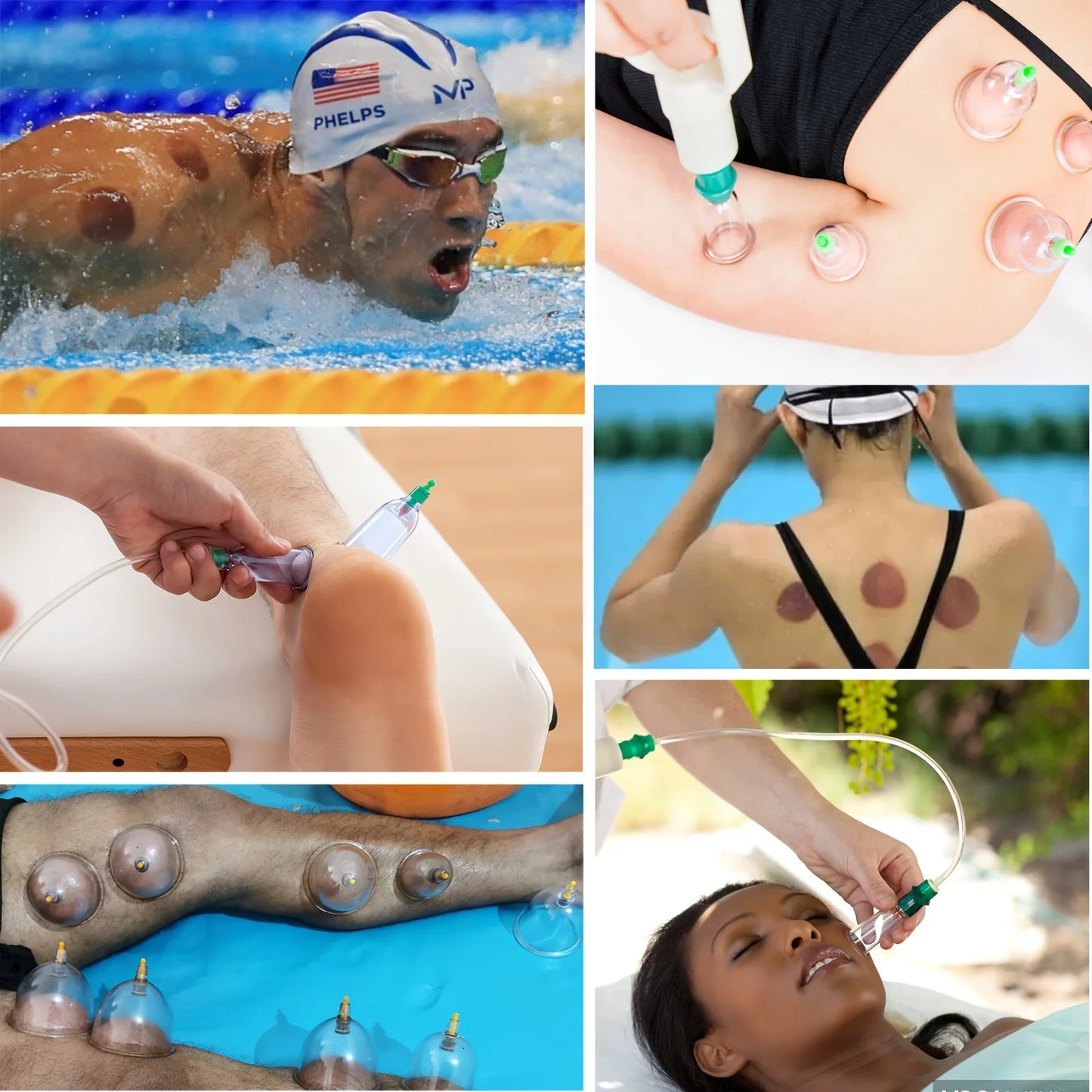 Cupping Therapy Set – Pain Relief & Muscle Relaxation & Pump for Cellulite