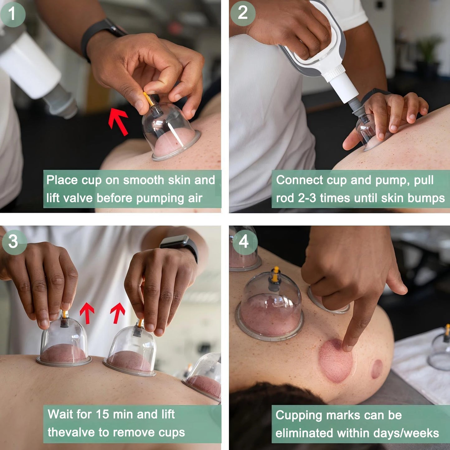 Cupping Therapy Set – Pain Relief & Muscle Relaxation & Pump for Cellulite
